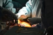 Ny behandling underlättar matchning vid njurtransplantation